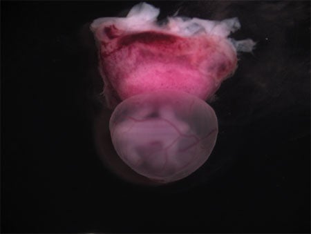 mouse_embryo_in_utero